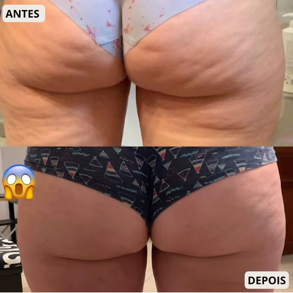 DermaShape