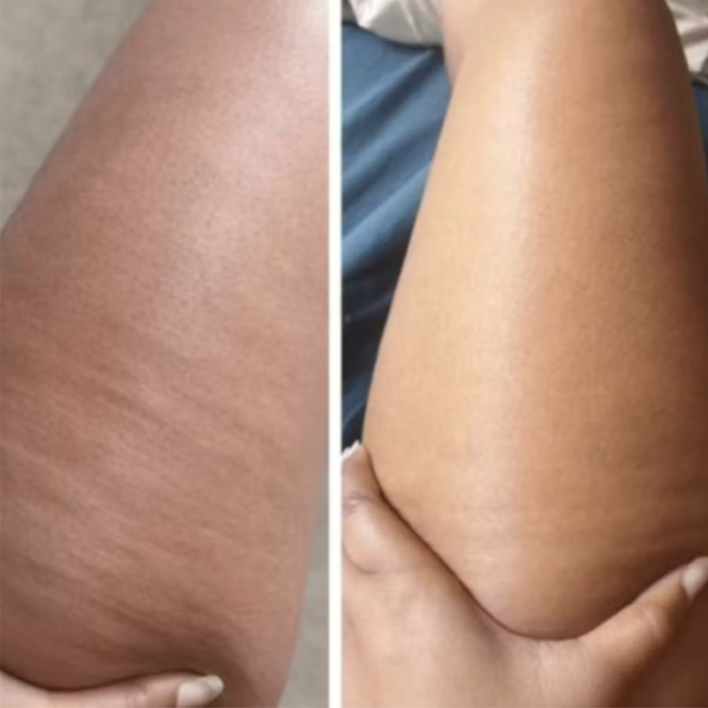 DermaShape