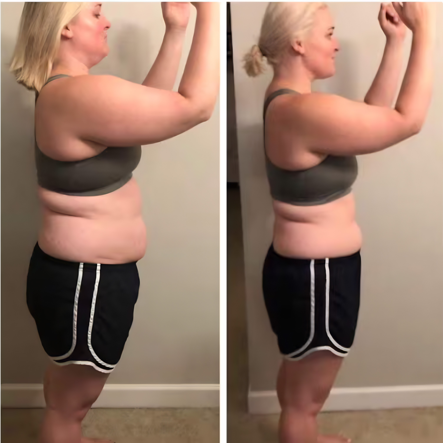 DermaShape