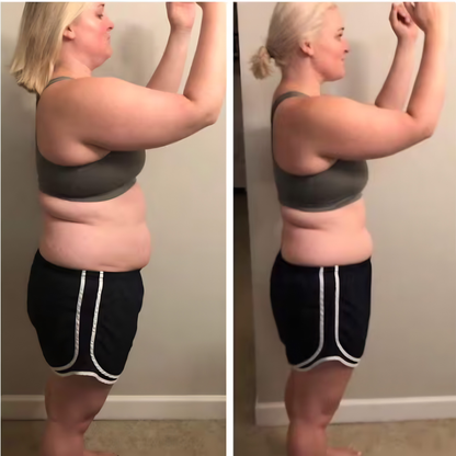 DermaShape