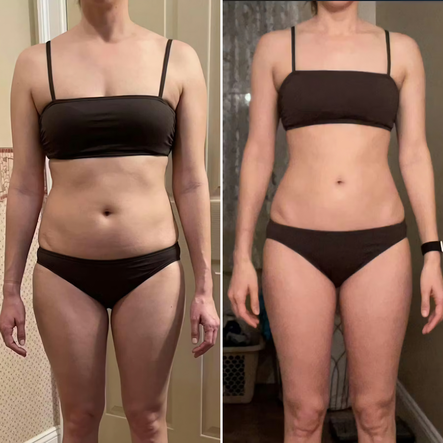 DermaShape