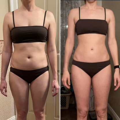 DermaShape