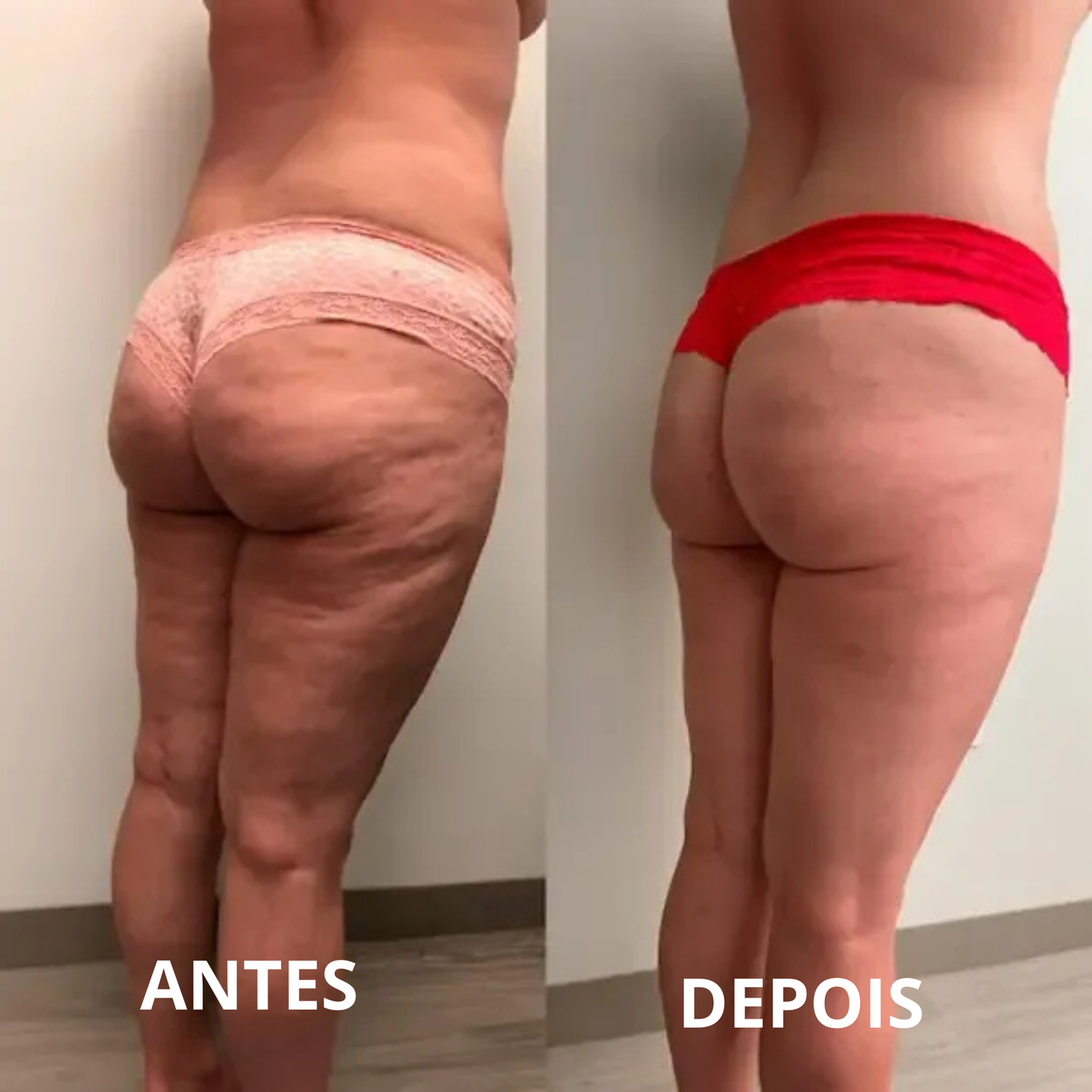 DermaSculpe