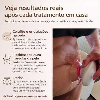 DermaSculpe