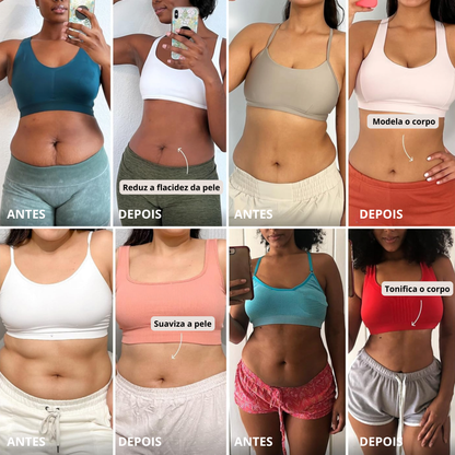 DermaShape