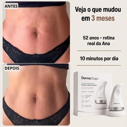 DermaShape